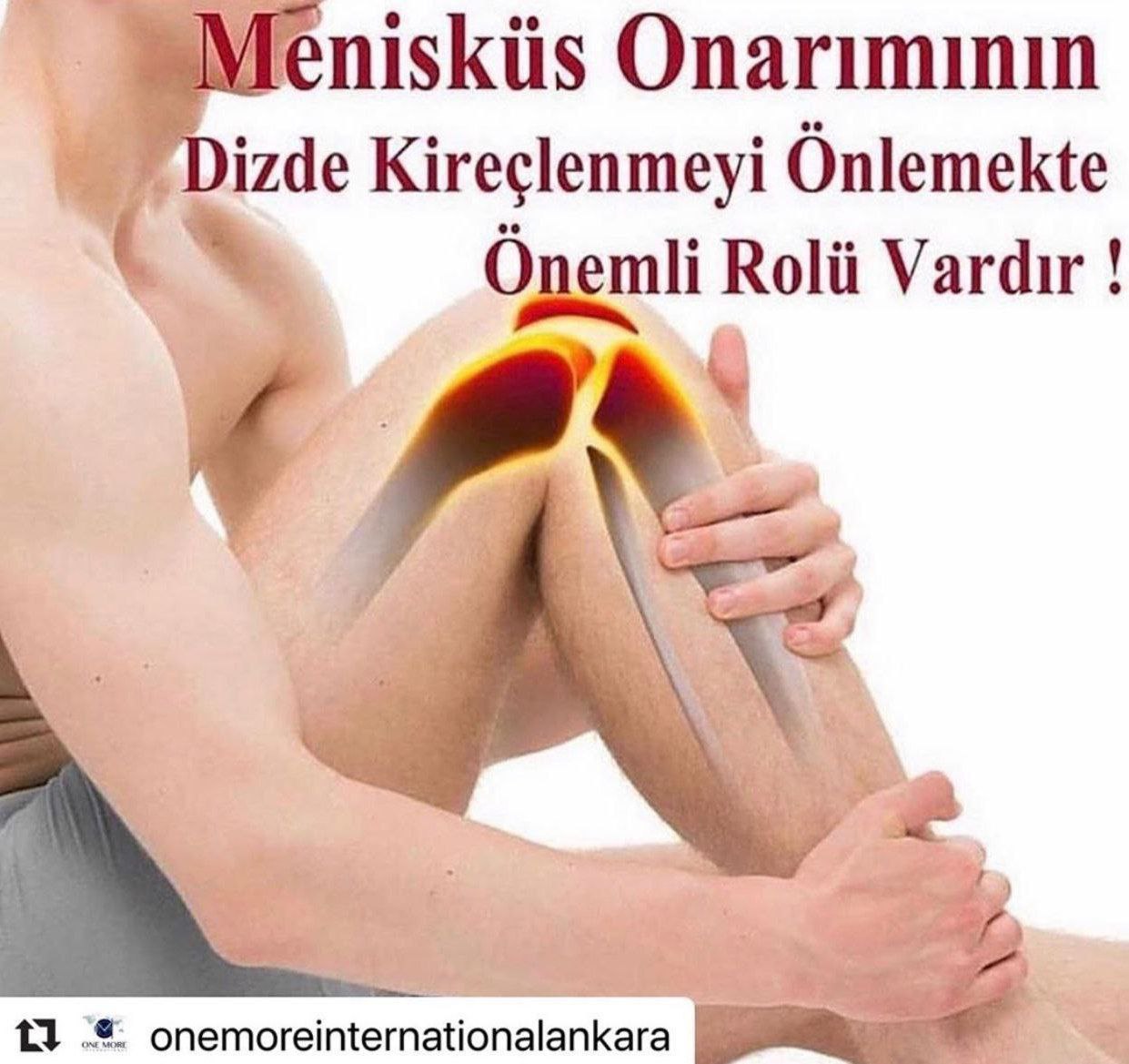 امویا ( OMEVIA )